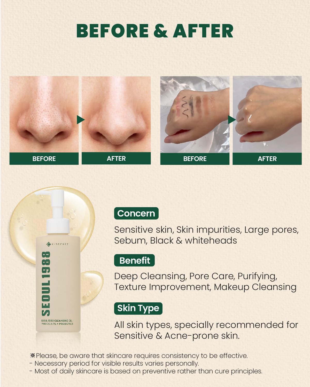KSECRET SEOUL 1988 Cleansing Oil : Pine Cica 1% + Probiotics, 200ml/6.76fl.oz.